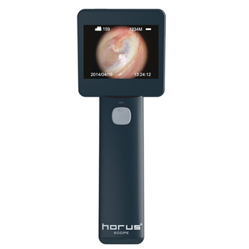 Отоскоп цифровий Medimaging Integrated Solution MIIS EOC100 Horus Digital Otoscope Full HD для діагностики слухового каналу