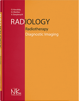 Radiology. Radiotherapy. Diagnostic Imaging Радіологія. Променева терапія. Променева діагностика. Видання 2. Ковальський О. В .та інші
