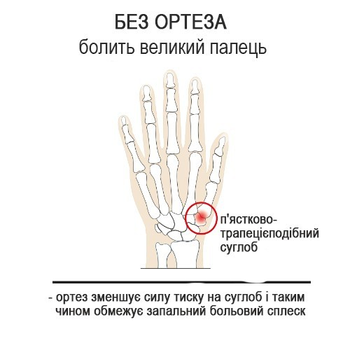EPITACT Ортез для большого пальца левой руки EP593SX3 гибкий, день, бежевый р-р. L
