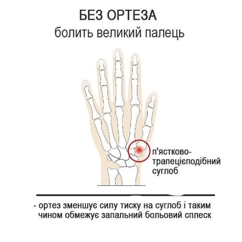 EPITACT Ортез великого пальця правої руки EP591DX1 гнучкий, день, бежевий р-р. S