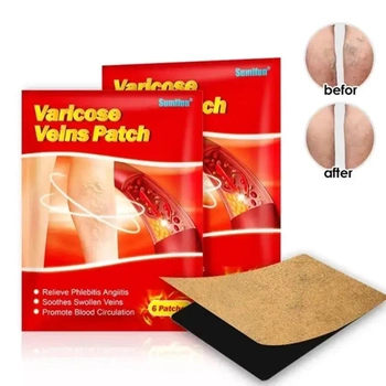Пластырь от варикоза UKC Varicose Veins Medical
