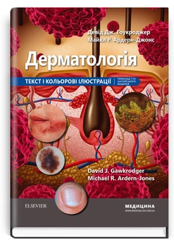 Дерматологія: текст і кольорові ілюстрації (9786175059371)