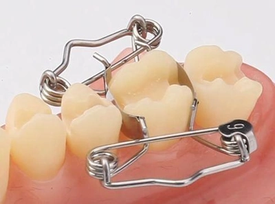BESTSELLER Набор из 25 зубных матриц Walser® с щипцами и лотком для стерилизации.