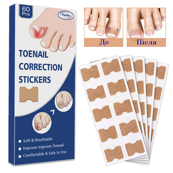 Пластир для корекції врослого нігтя Toenail Correction Sticker 60 шт