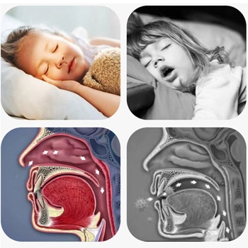 Полоски для обеспечения носового дыхания во сне Kids Sleep Strips 30 шт Детские Large РК012
