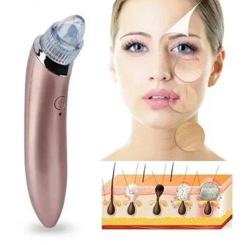 Апарат для вакуумного чищення обличчя Beauty Skin Care Specialist XN-8030 Pink