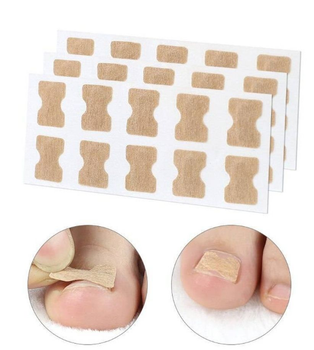 Наклейки тейпы от Врастания Ногтя при деформации ногтевой пластины для коррекции ногтя набор пластырей 50 шт (AN)20461 2ф