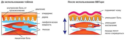 Кинезио тейп Epos Tape 10 см х 5 м Южная Корея бежевый