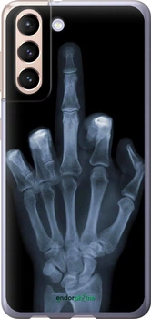 Чехол на Samsung Galaxy S21 Рука через рентген "1007u-2114-70447"