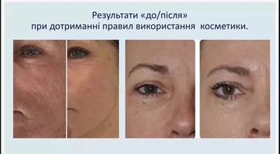 Зволожувальний денний крем для обличчя Resurface Dr. C. Tuna, 50 мл