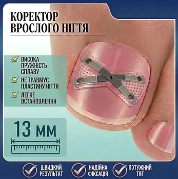 Коректор врослого нігтя X-подібний, нікелевий сплав Ingrown Toenail Correction Kit, Розмір 13 мм