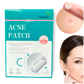 Патчи от прыщей и акне противовоспалительные 72 шт Acne Patch LS-1048