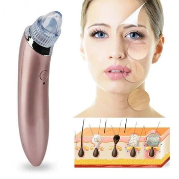 Апарат для вакуумного чищення шкіри Beauty Skin Care Specialist XN-8030, потужність вакуумного тиску 50 кПа, робота від