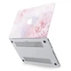 Чехол пластиковый для Apple MacBook (Нежный цветок) Air 11 A1370/A1465 макбук эйр - изображение 4