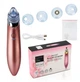 Вакуумный очиститель кожи Beauty Skin Care Specialist XN-8030 - изображение 1