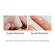 Гідрофільна олія Celimax Derma Nature Fresh Blackhead Jojoba Cleansing Oil для зняття макіяжу 150 мл - зображення 3