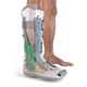 Ортез голеностопного сустава DONJOY 01PD XP DIABETIC, WOLKER SYSTEM размер L - изображение 4