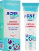 Звужуючий пори гель-крем - Dermacol AcneClear Pore Minimizer 50ml (926679-15432) - изображение 2