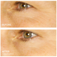 Гидрогелевые патчи с коллоидным серебром BeautyBio Bright Eyes Depuffing and Brightening Eye Gels 1 пара - изображение 6