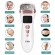 Аппарат для RF-лифтинга, подтяжки и омоложения лица UPG Magic Mini HIFU+гель, white - изображение 5