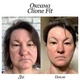 Японский аппарат 5 в 1 с передовыми технологиями для лица Clione Fit - изображение 7