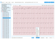 Холтер Lepu Medical TH12 12 канальный с программным обеспечением (6941900605794) - изображение 5