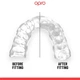 Капа OPRO Instant Custom-Fit UFC Strike Black Silver (OIC-UFCStrike-BKWH) - изображение 2
