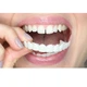 Виниры Съемные Veneers Snap-on №26 / Универсальный размер - изображение 3