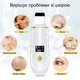 Ультразвуковий скрабер Ultrasonic Skin Cleaner GMCX6 з LED-дисплеєм, іонізацією і функцією нагрівання - зображення 6