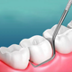 Набір інструментів для чищення зубів Dental Toothpick Set - зображення 6