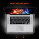 Охлаждающая Подставка для Ноутбука MeeTion CoolingPad CP3030 c RBG Подсветкой, Регулировкой высоты |9-15.6"| - изображение 11