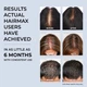 HairMax LaserBand 41 (США) ComfortFlex Обруч с лазером для роста волос - изображение 4