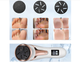 Электрическая пемза для удаления мозолей стоп Callus Remover mt 510 - изображение 13