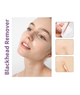 Набор для чистки лица Moday Blackhead Remover — инструменты для удаления угрей комедонов и черных точек двусторонние косметологические петли 4 инструмента 8 насадок - изображение 4
