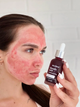 Кислотна пілінг-сироватка для обличчя Glycolic Acid Hollyskin 30 мл - изображение 3