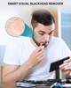 Прибор для удаления ушной серы отоскоп XKOO Ear Wax Removal R1 Pro 1080P. - изображение 6