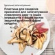 Сэндвичница-бутербродница BRAUN Snack Maker 5 SM5005 - изображение 9
