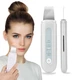 Скрабер портативный ультразвуковой для чистки лица с EMS и ионизацией Beauty Effect WAU-55 - изображение 1