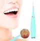 Скалер ультразвуковий очищувач зубів від каменю Dental Calculus Remove Green - изображение 1