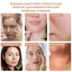 Лифтинг-массажер для лица EMS микроток MEDICA+ SKIN LIFTING 6.0 PINK - изображение 14