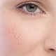 Płyn micelarny Dermedic Redness Calm H2O do demakijażu 500 ml (5901643176389) - obraz 2