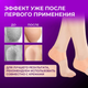 Силиконовая защита для пяток Heel Anti-Crack Sets Носочки на пятки накладка от мозолей - изображение 5