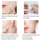 Патчи от прыщей Sersanlove ACNE PATCH (экстракт чайного дерева), 72 шт - изображение 2