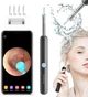 Умная ушная палочка Bebird R1 Black - изображение 5