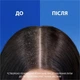 Шампунь Head & Shoulders Проти лупи Яблучна свіжість 800 мл (8700216306782) - зображення 3