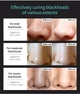 Маска для лица от черных точек LANBENA Blackhead Remover Mask 50 г - изображение 7