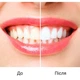 Гель для отбеливания, осветления и чистки зубов Smile, фиолетовый, 30 мл - изображение 7