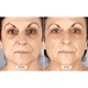 Светодиодная маска CurrentBody Skin Mask LED Visage - изображение 4