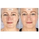 Набор CurrentBody Skin LED Light Therapy Face Neck Kit для лица, шеи и зоны декольте - изображение 5