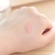 Гипоаллергенная сыворотка-пилинг для лица с липогидроксикислотой Medi-Peel LHA Soonsoo Peel Serum 20 ml - изображение 2